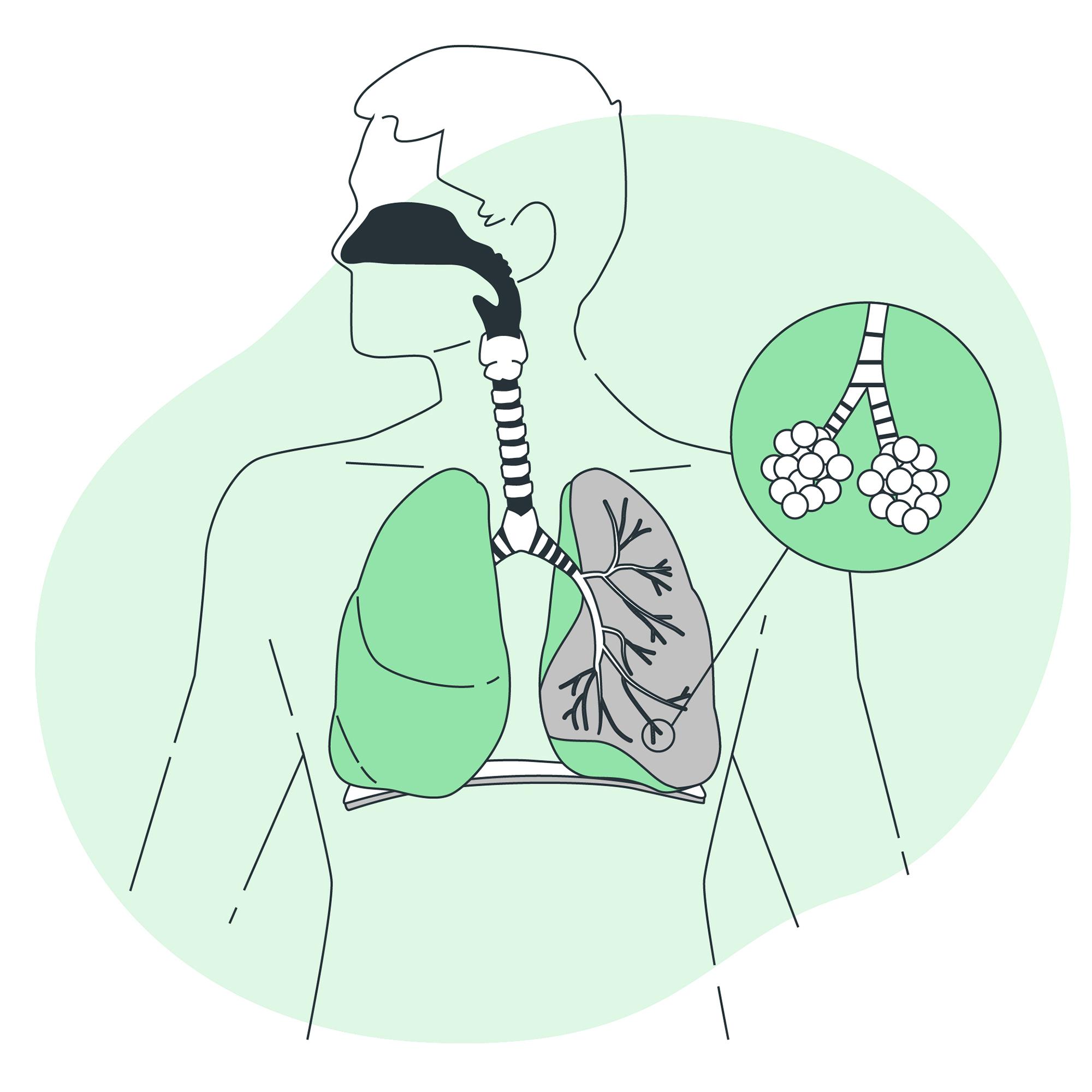 Speciality Clinic – Tuberculosis Clinic